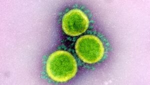 amburgo virus marburg